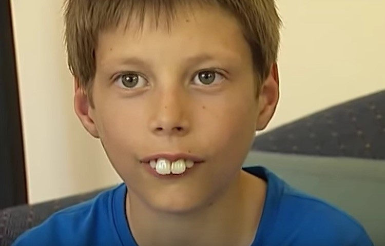 10 boy thumb sucking teeth