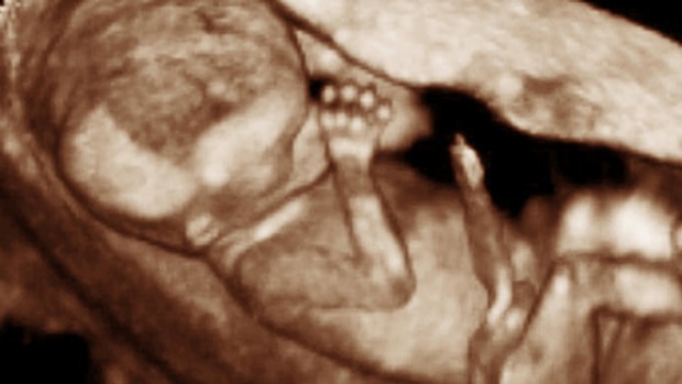 Unborn babies 